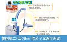 ����Xtrac-308nm׼���Ӽ�������ϵͳ